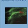 Shigella: Molecular and Cellular Biology