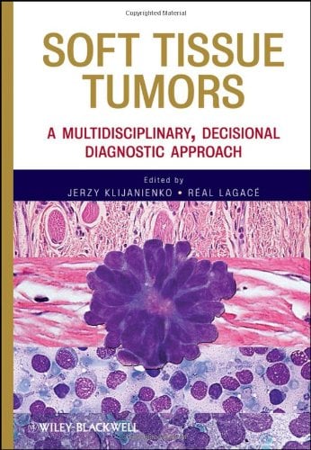 Soft Tissue Tumors: A Multidisciplinary, Decisional Diagnostic Approach (Original PDF from Publisher)