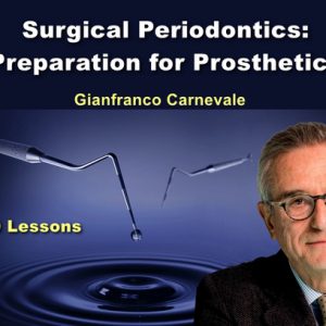 OHI-S Surgical periodontics: preparation for prosthetics (Videos)