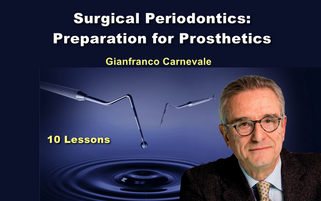 OHI-S Surgical periodontics: preparation for prosthetics (Videos)