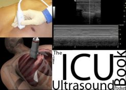 The ICU Ultrasound Pocket Book (Original PDF from Publisher)