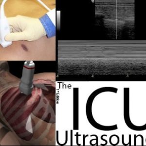 The ICU Ultrasound Pocket Book (Original PDF from Publisher)