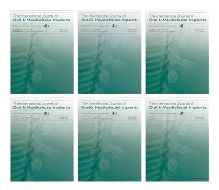 The International Journal of Oral & Maxillofacial Implants 2022 Full Archives (True PDF)