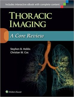 Thoracic Imaging: A Core Review (EPUB)