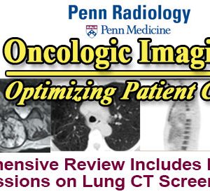 Penn Radiology Oncologic Imaging – Optimizing Patient Care 2016 (Videos)