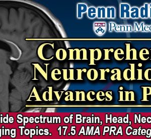 Penn Radiology Comprehensive Neuroradiology: Advances in Practice 2024 (Videos)