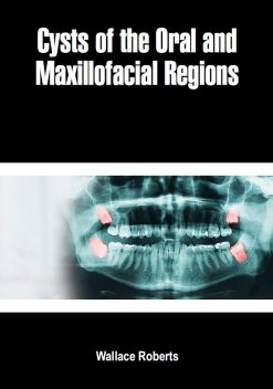 Cysts Of The Oral And Maxillofacial Regions (Original PDF from Publisher)
