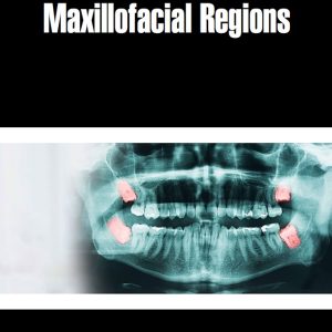 Cysts Of The Oral And Maxillofacial Regions (Original PDF from Publisher)