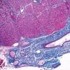 Current Topics in Gastrointestinal and Liver Pathology 2023 (John Hopkins) (Videos)