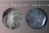 Advanced Breast Imaging 2024 – CMEScience (Videos)