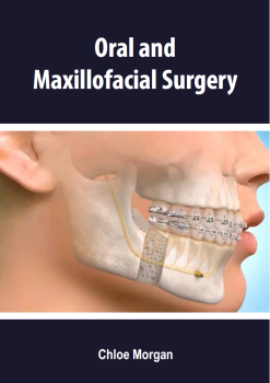 Oral and Maxillofacial Surgery (Original PDF from Publisher)