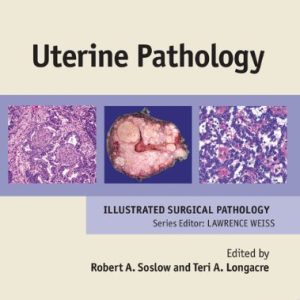 Uterine Pathology (Cambridge Illustrated Surgical Pathology)