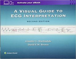 A Visual Guide to ECG Interpretation, Second Edition (EPUB)