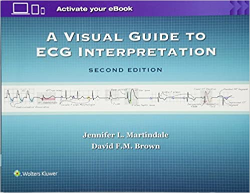 A Visual Guide to ECG Interpretation, Second Edition (EPUB)