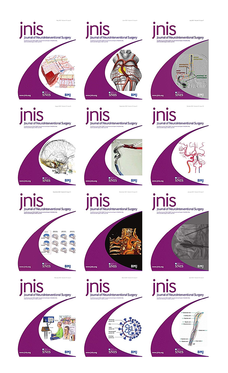 Journal of NeuroInterventional Surgery 2021 Full Archives (True PDF)