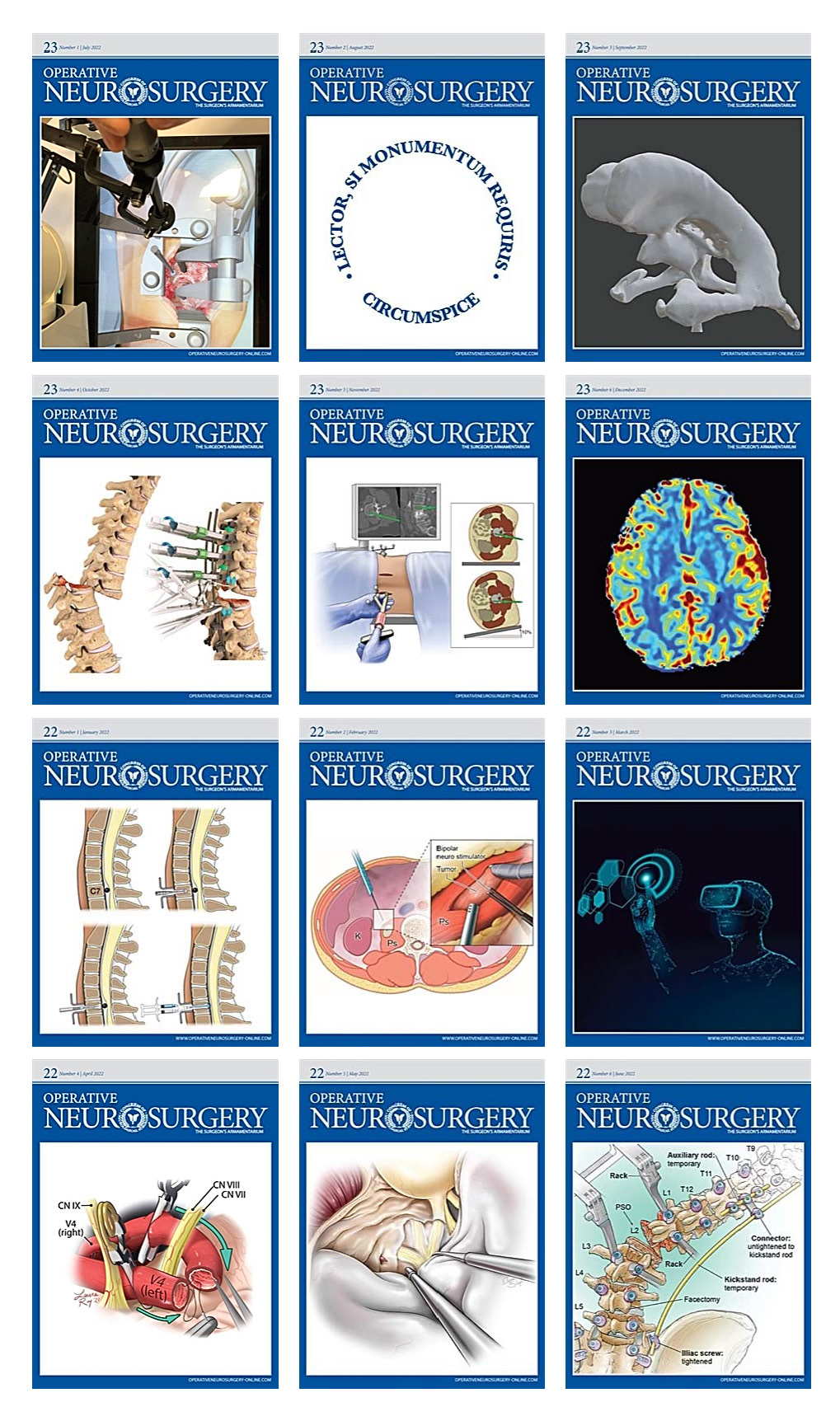 Operative Neurosurgery 2022 Full Archives (True PDF)