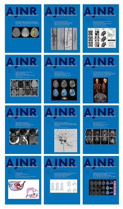 American journal of Neuroradiology 2022 Full Archives (True PDF)