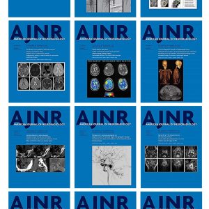 American journal of Neuroradiology 2022 Full Archives (True PDF)
