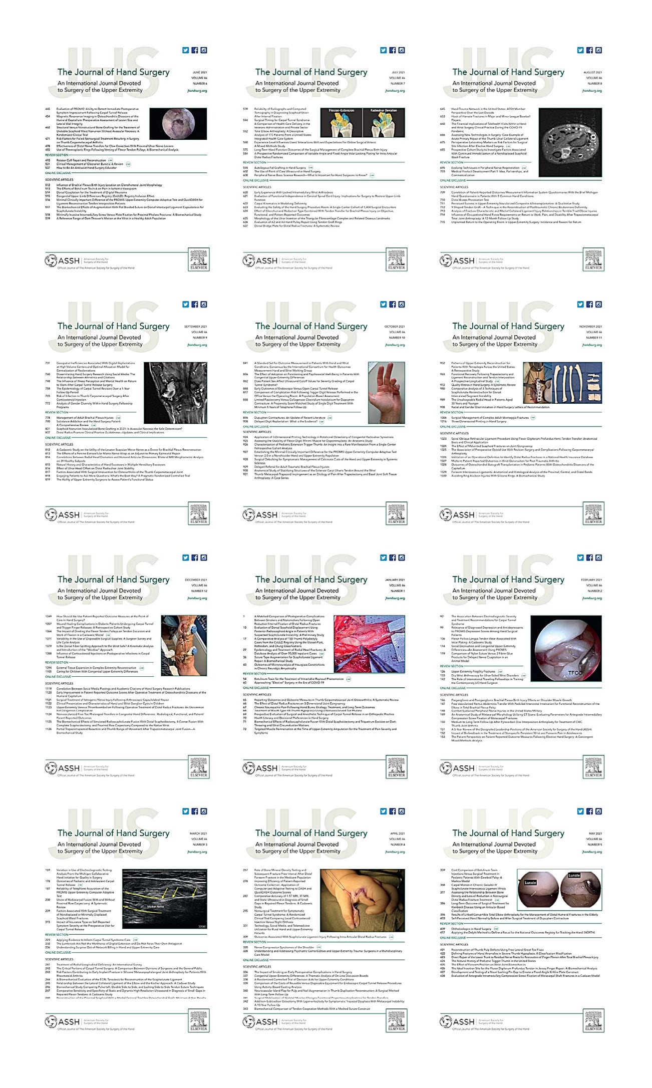 The Journal of Hand Surgery 2021 Full Archives (True PDF)