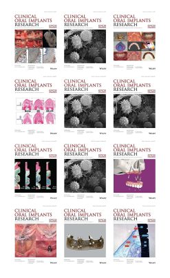 Clinical Oral Implants Research 2021 Full Archives (True PDF)