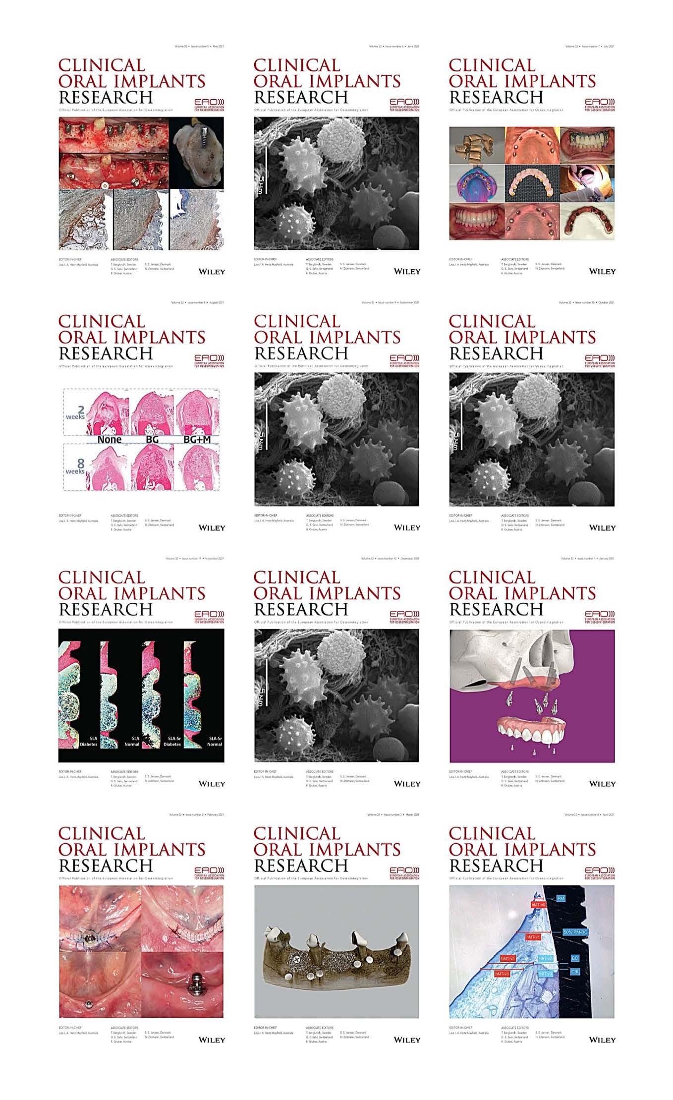 Clinical Oral Implants Research 2021 Full Archives (True PDF)
