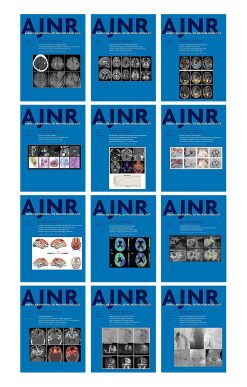 American journal of Neuroradiology 2021 Full Archives (True PDF)