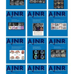 American journal of Neuroradiology 2021 Full Archives (True PDF)