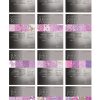 American Journal of Surgical Pathology 2021 Full Archives (True PDF)