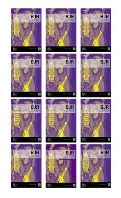 British Journal of Radiology 2021 Full Archives (True PDF)