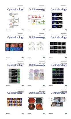 British Journal of Ophthalmology 2022 Full Archives (True PDF)
