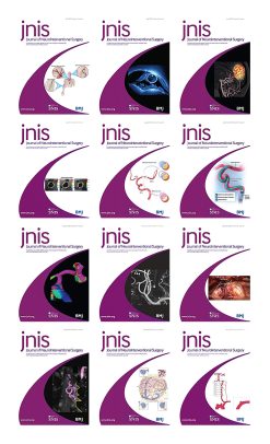 Journal of NeuroInterventional Surgery 2022 Full Archives (True PDF)