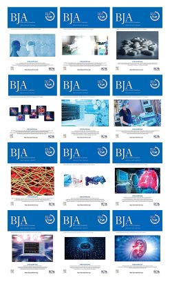 British Journal of Anaesthesia 2022 Full Archives (True PDF)