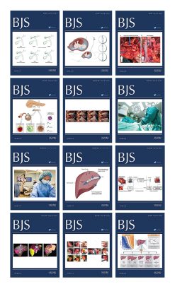 British Journal of Surgery 2021 Full Archives (True PDF)