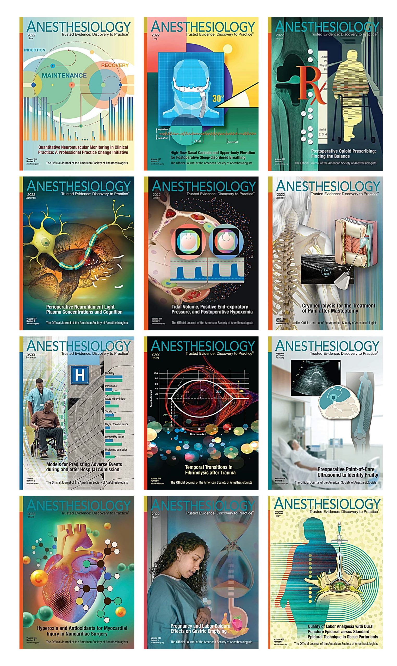 Anesthesiology 2022 Full Archives (True PDF)