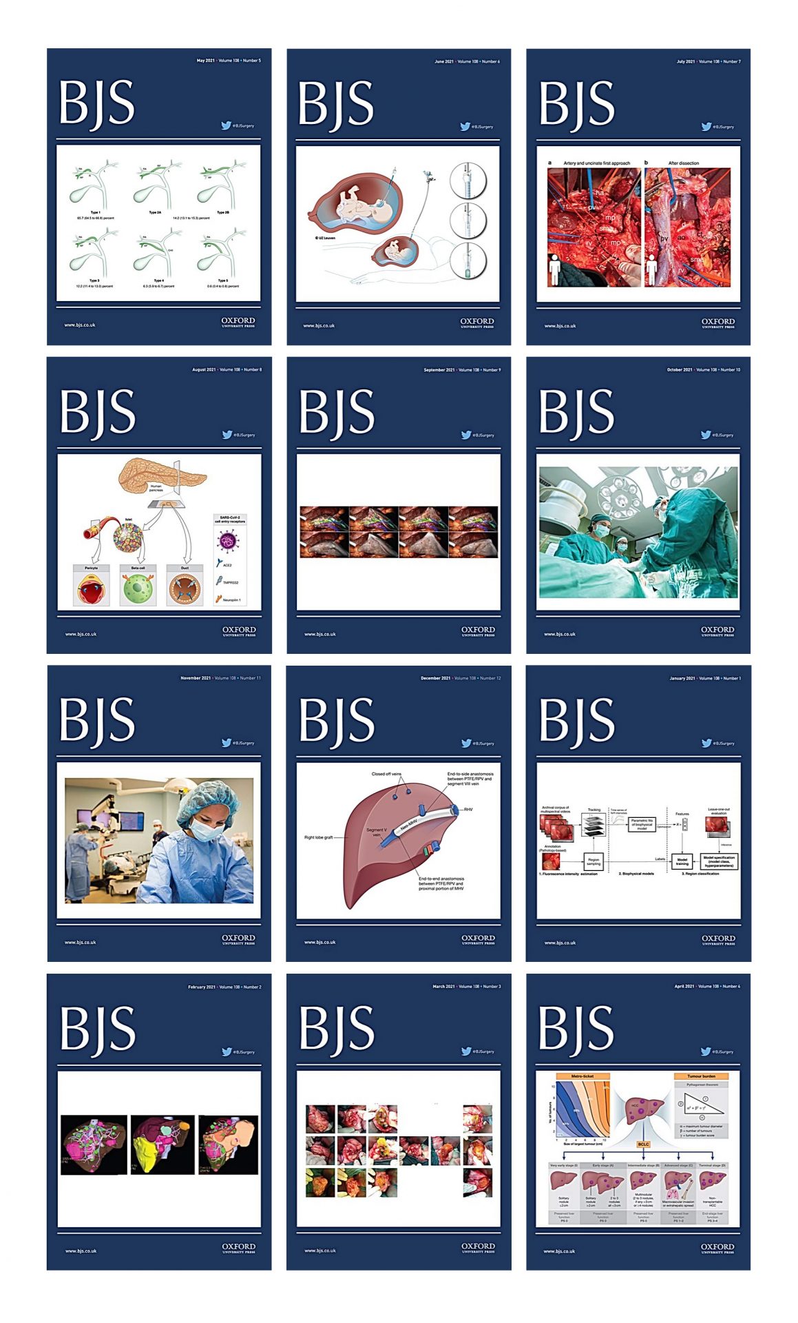 British Journal of Surgery 2021 Full Archives (True PDF)