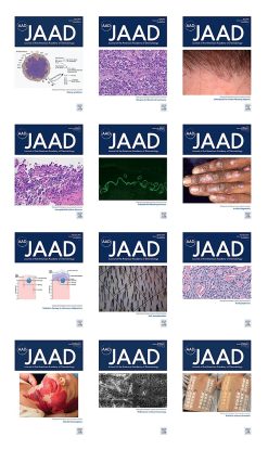 Journal of the American Academy of Dermatology 2021 Full Archives (True PDF)