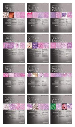 American Journal of Surgical Pathology 2022 Full Archives (True PDF)