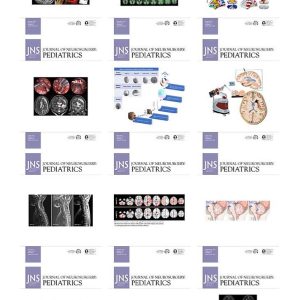 Journal of Neurosurgery: Pediatrics 2021 Full Archives (True PDF)