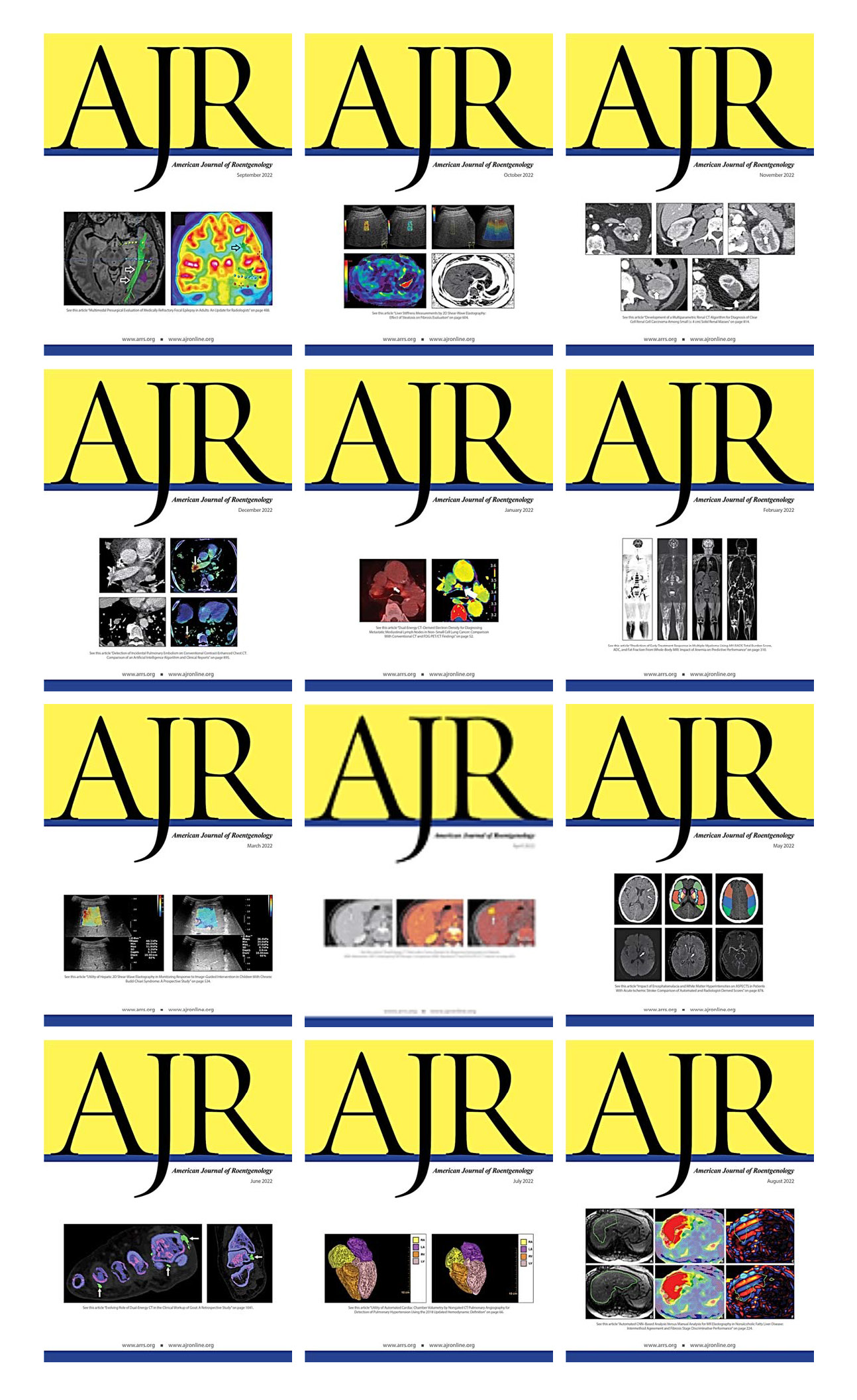 American Journal of Roentogelogy 2022 Full Archives (True PDF)