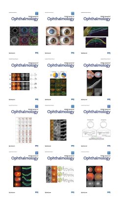 British Journal of Ophthalmology 2021 Full Archives (True PDF)