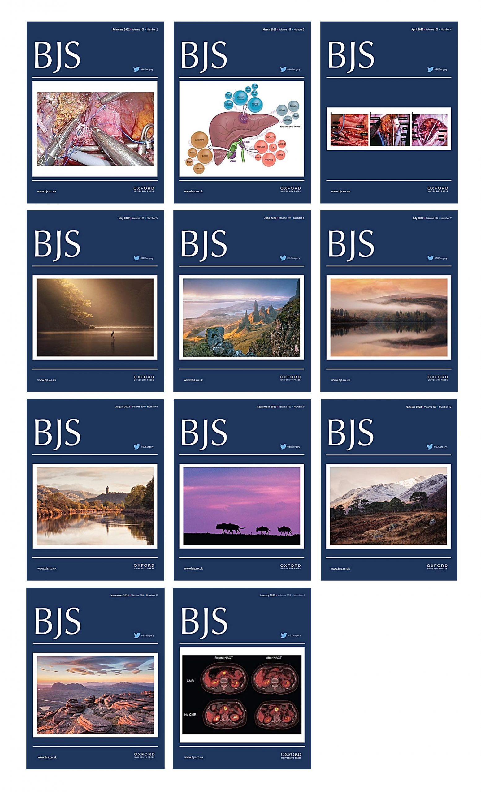 British Journal of Surgery 2022 Full Archives (True PDF)