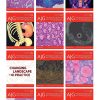 American Journal of Gastroenterology 2021 Full Archives (True PDF)