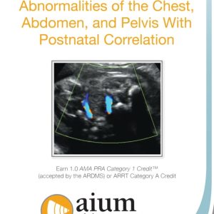 AIUM Prenatal Ultrasound Abnormalities of the Chest, Abdomen, and Pelvis With Postnatal Correlation (Videos)