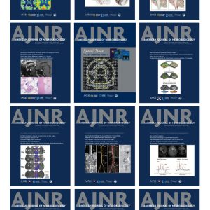 American journal of Neuroradiology 2024 Full Archives (True PDF)