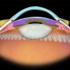 MRIOnline Imaging Mastery Series Orbit 2019 (Videos)