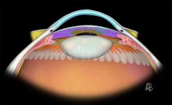MRIOnline Imaging Mastery Series Orbit 2019 (Videos)
