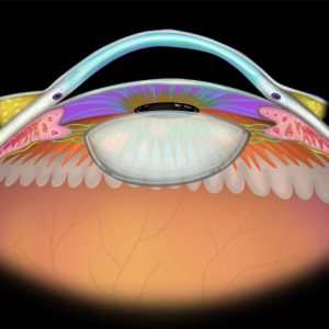 MRIOnline Imaging Mastery Series Orbit 2019 (Videos)