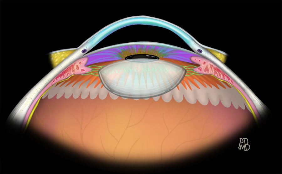MRIOnline Imaging Mastery Series Orbit 2019 (Videos)