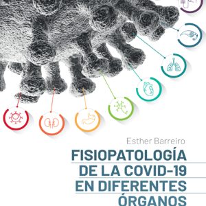 Fisiopatología de la COVID-19 en diferentes órganos y sistemas (Original PDF from Publisher)