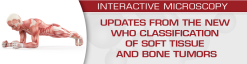 USCAP Updates from the New WHO Classification of Soft Tissue and Bone Tumors 2020 (Videos)